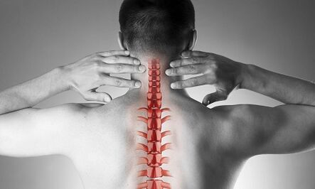 Wie äußert sich eine Osteochondrose der Halswirbelsäule