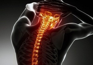 Regeln für die Behandlung von zervikaler Osteochondrose